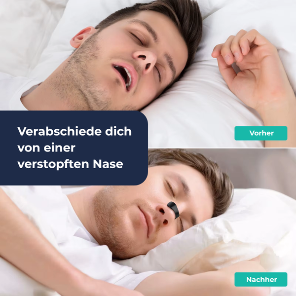 AtmungsPro Nasenöffner Set